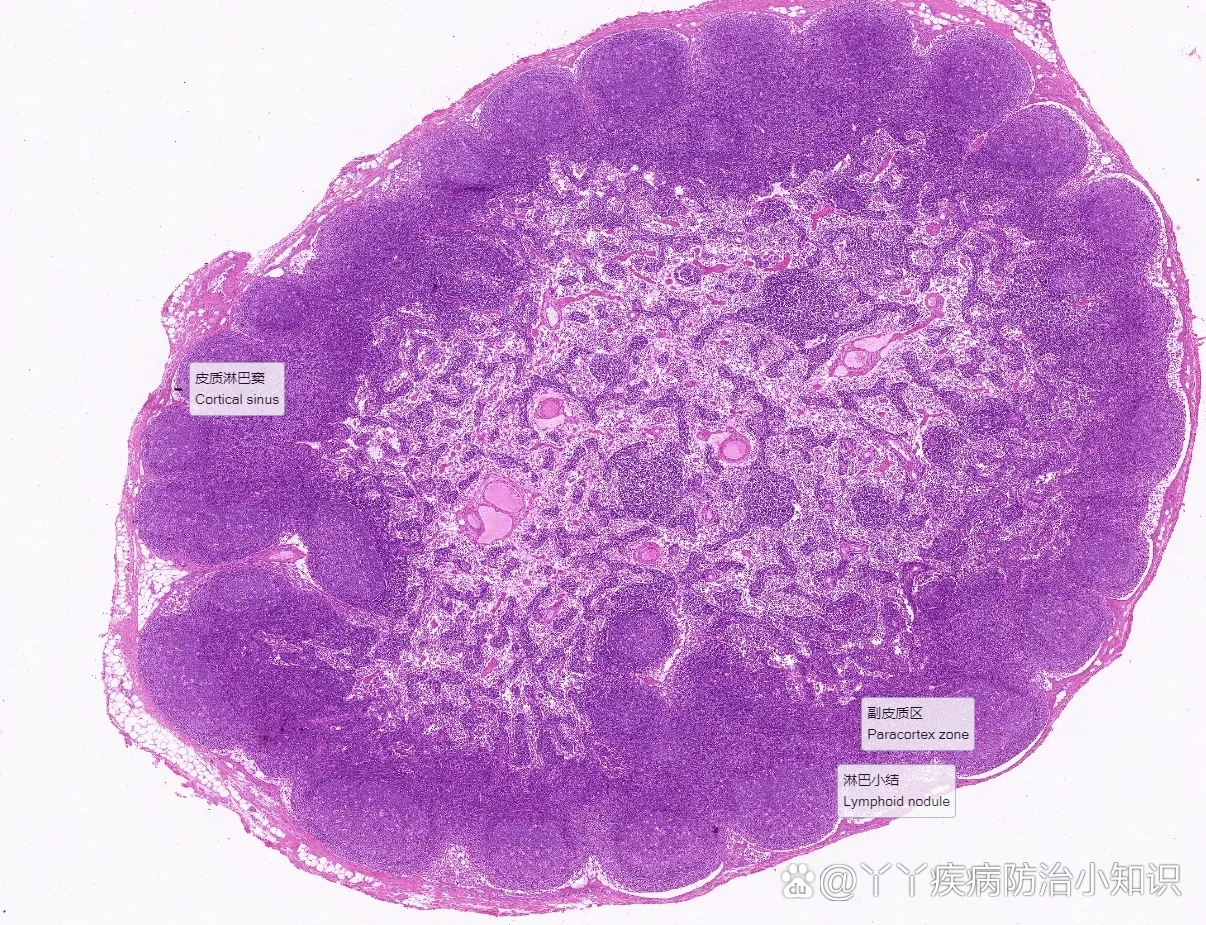 免疫系统:淋巴结