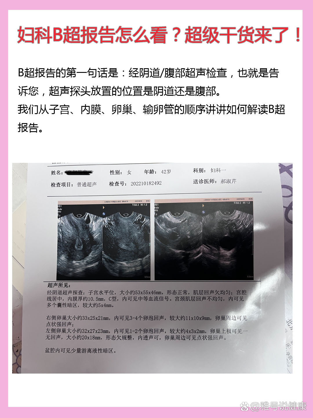 如何看懂腹部彩超图图片