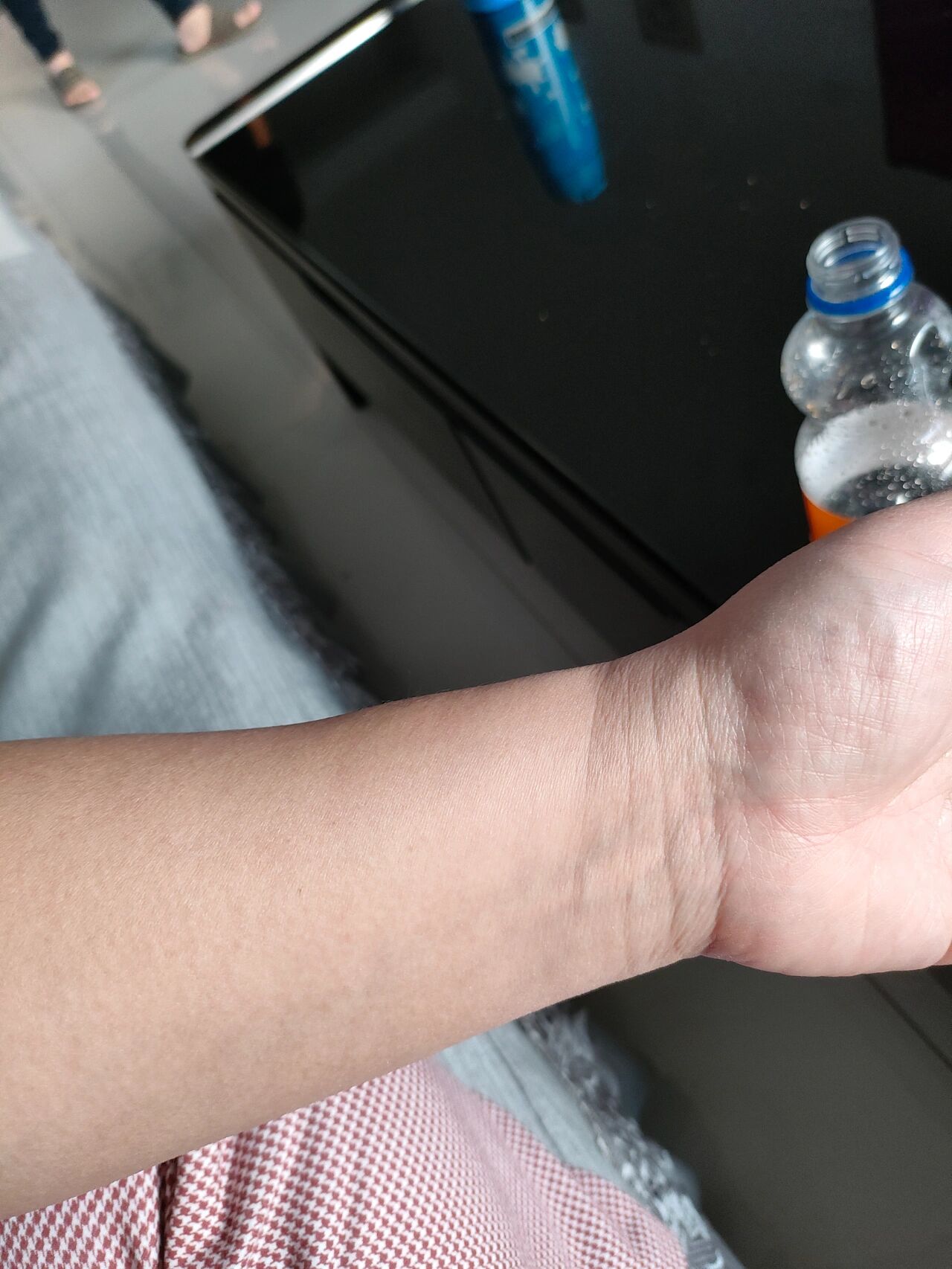 手腕上方这肿起来的不疼是血管吗?