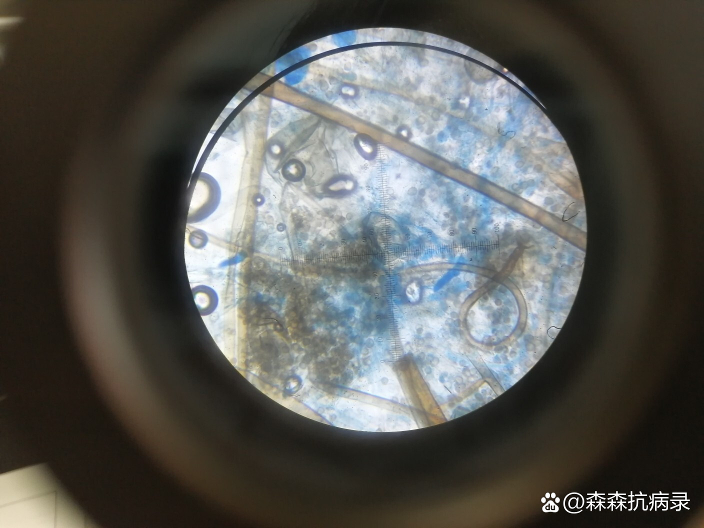 显微镜94下的真菌9699