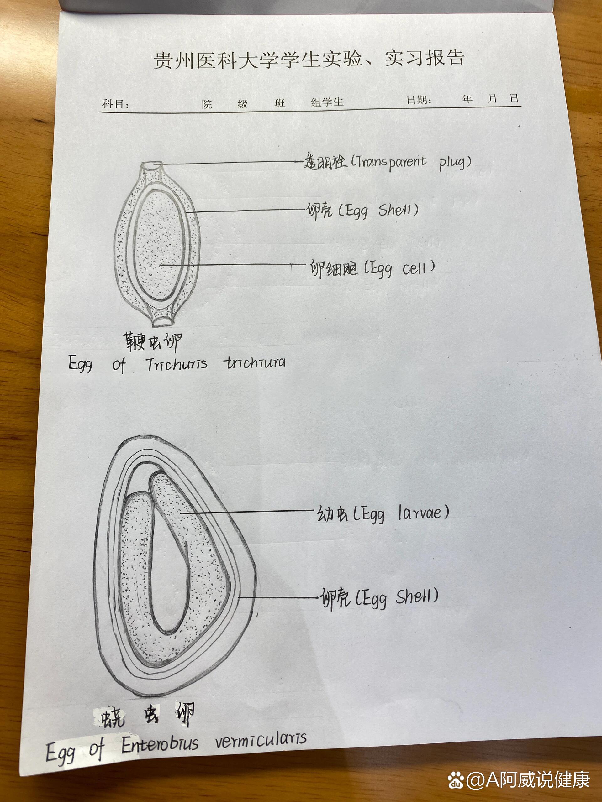 犬弓首蛔虫虫卵手绘图图片