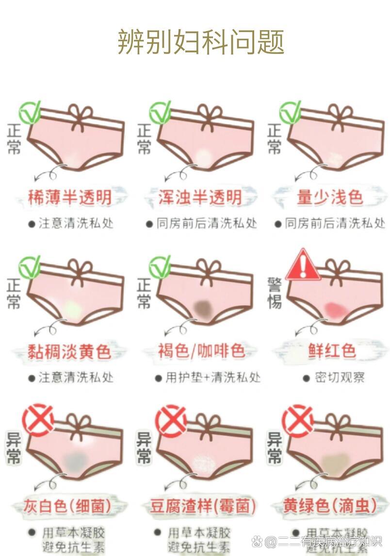 你的白带正常吗?