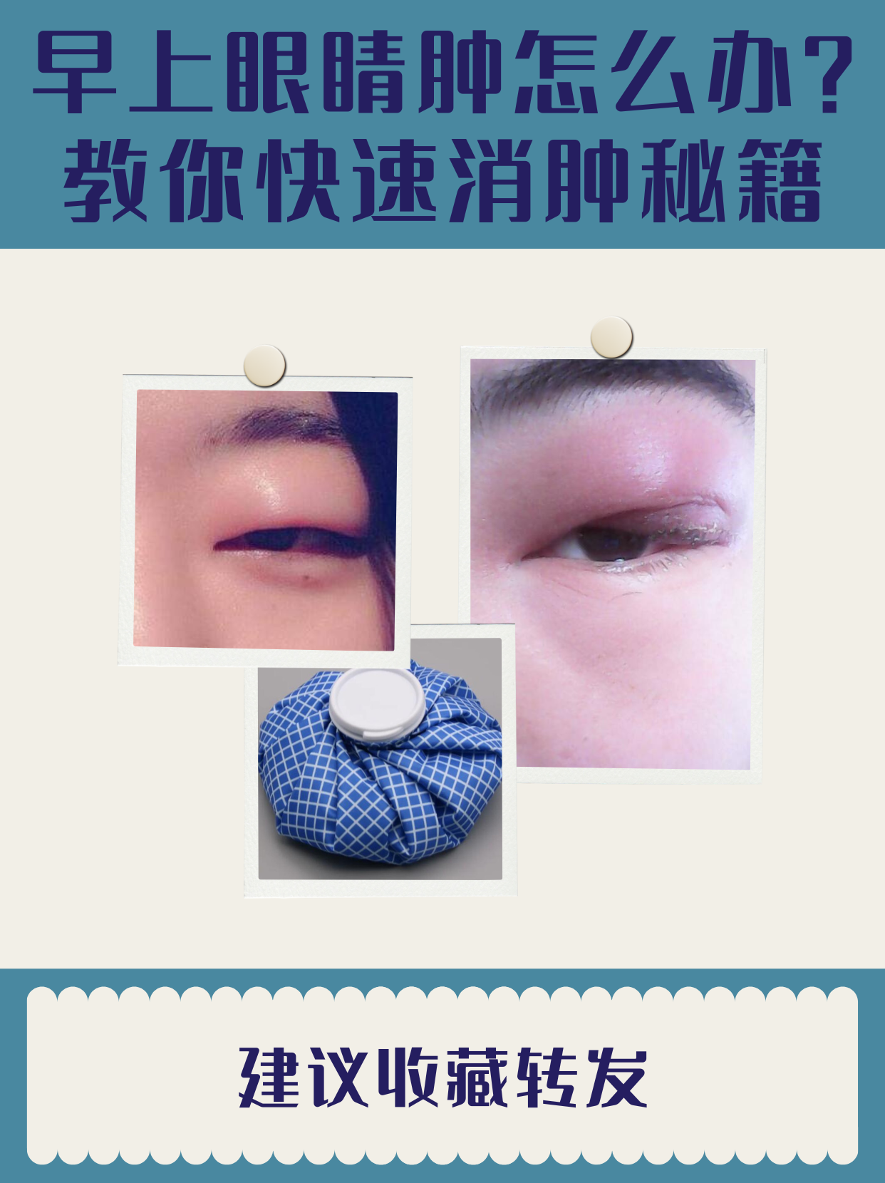 为什么眼皮会肿