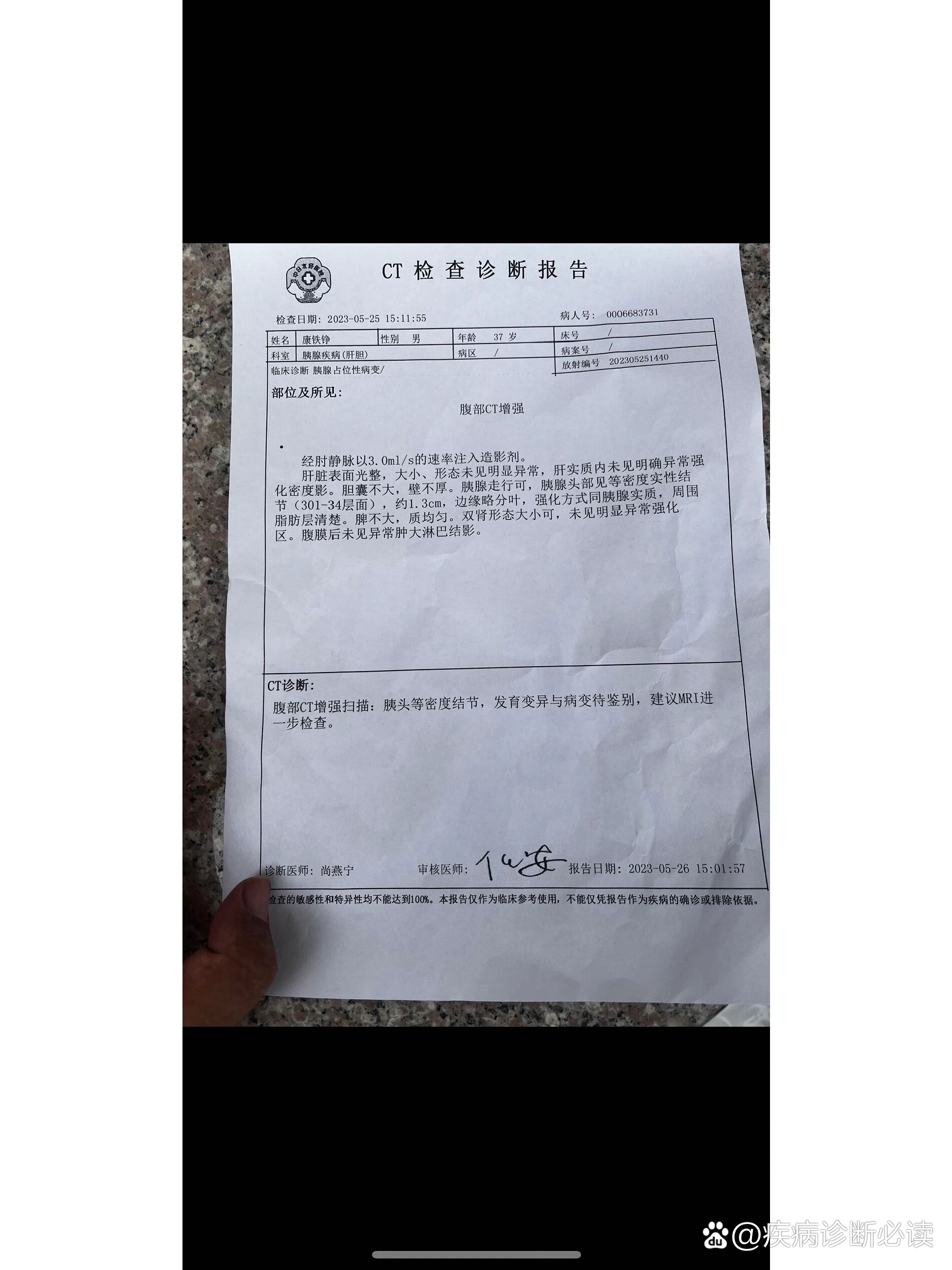 我到底是不是胰腺癌啊,老师们帮我看看