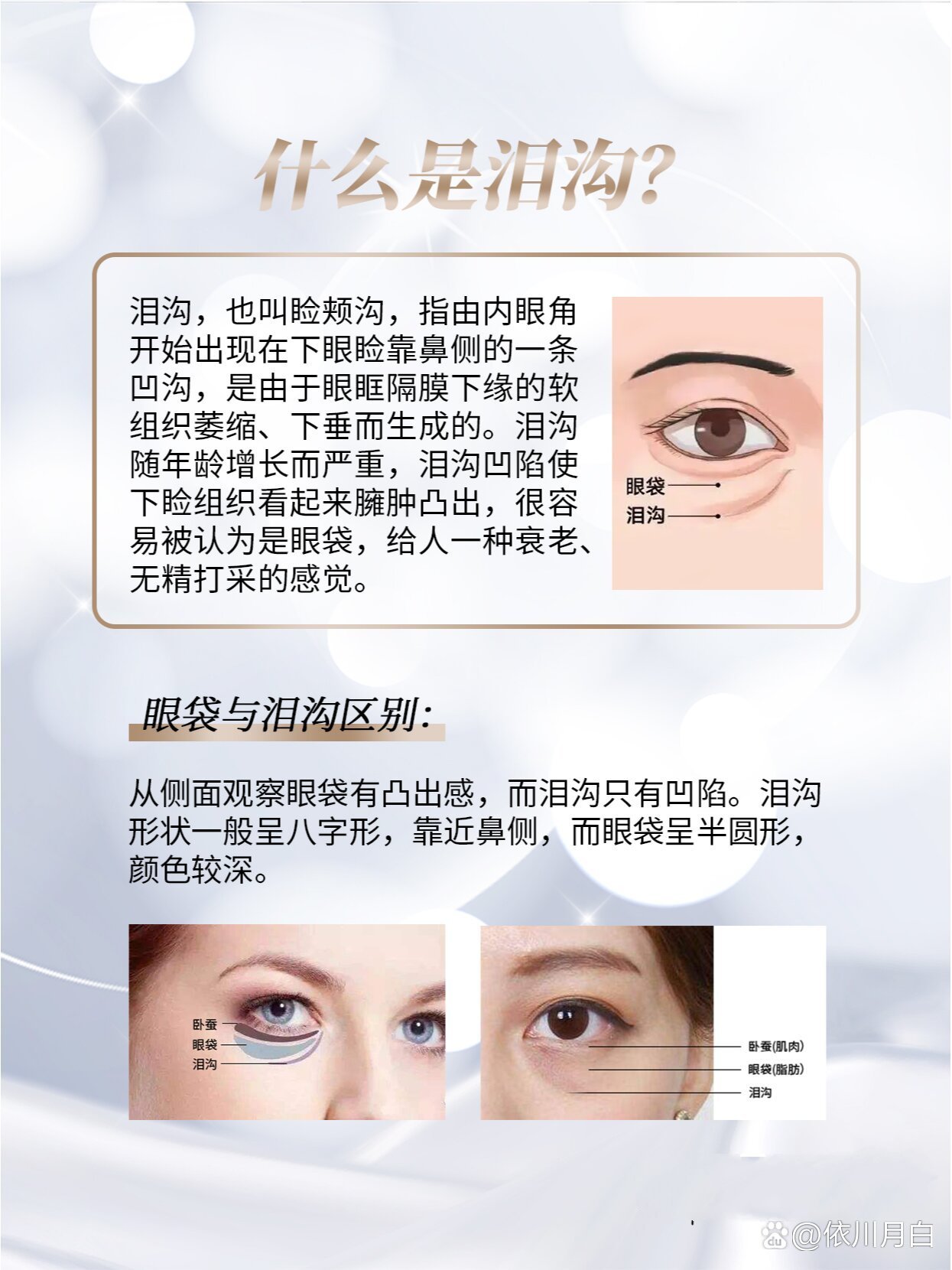  br>抗衰路上三道杠:泪沟,法令纹,木偶纹 br>今天我们来了解下让倦容