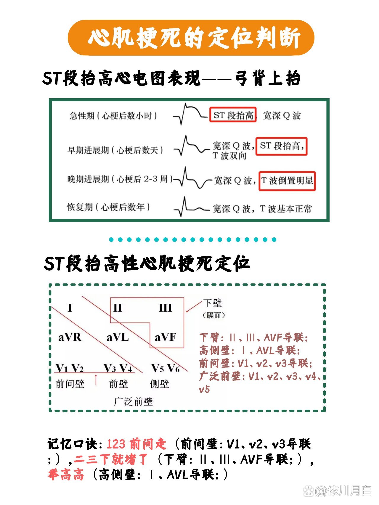 一张图学会心电图 心肌梗死的定位判断