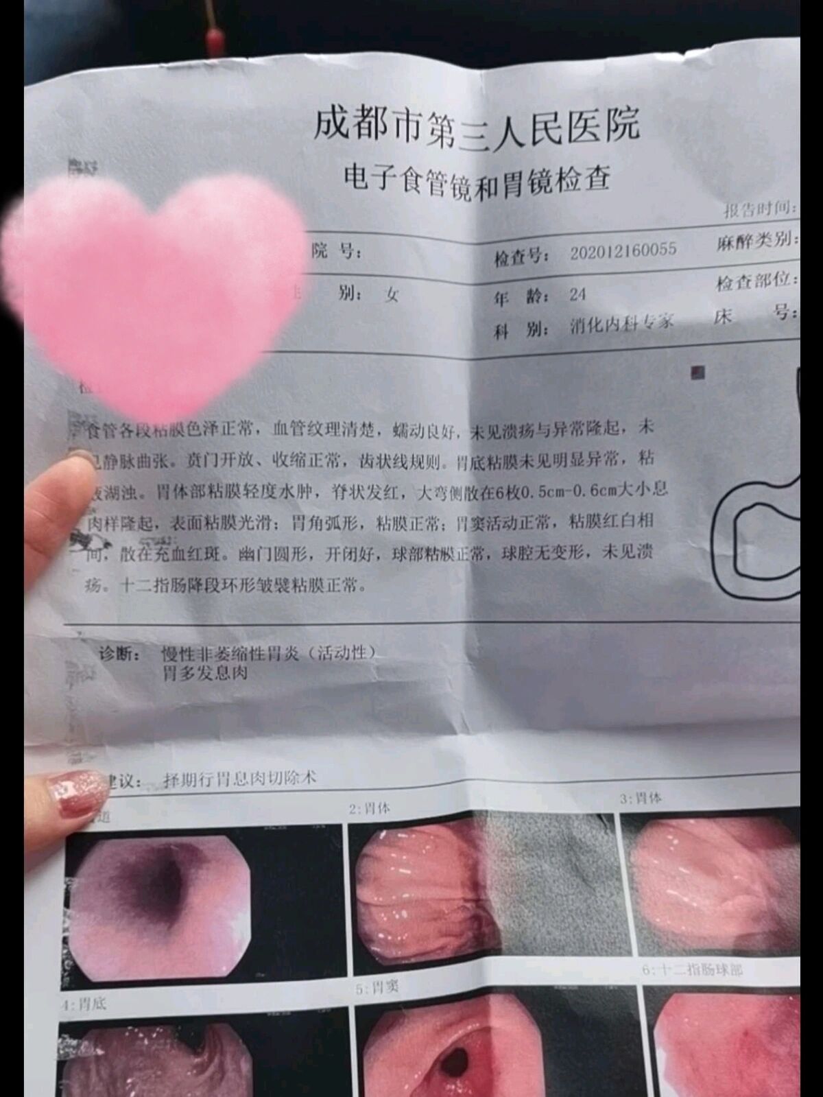 成都胃镜—费用,如何预约