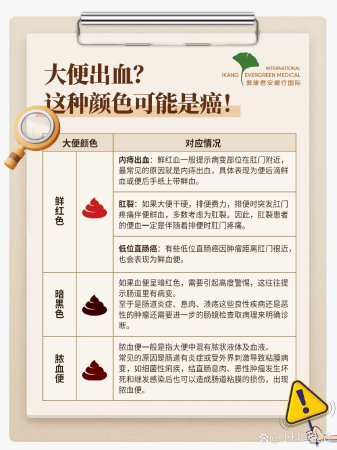 大便出血 这种颜色可能是癌 ️