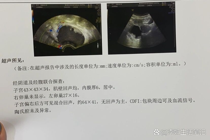 右附件长了个囊实性包块