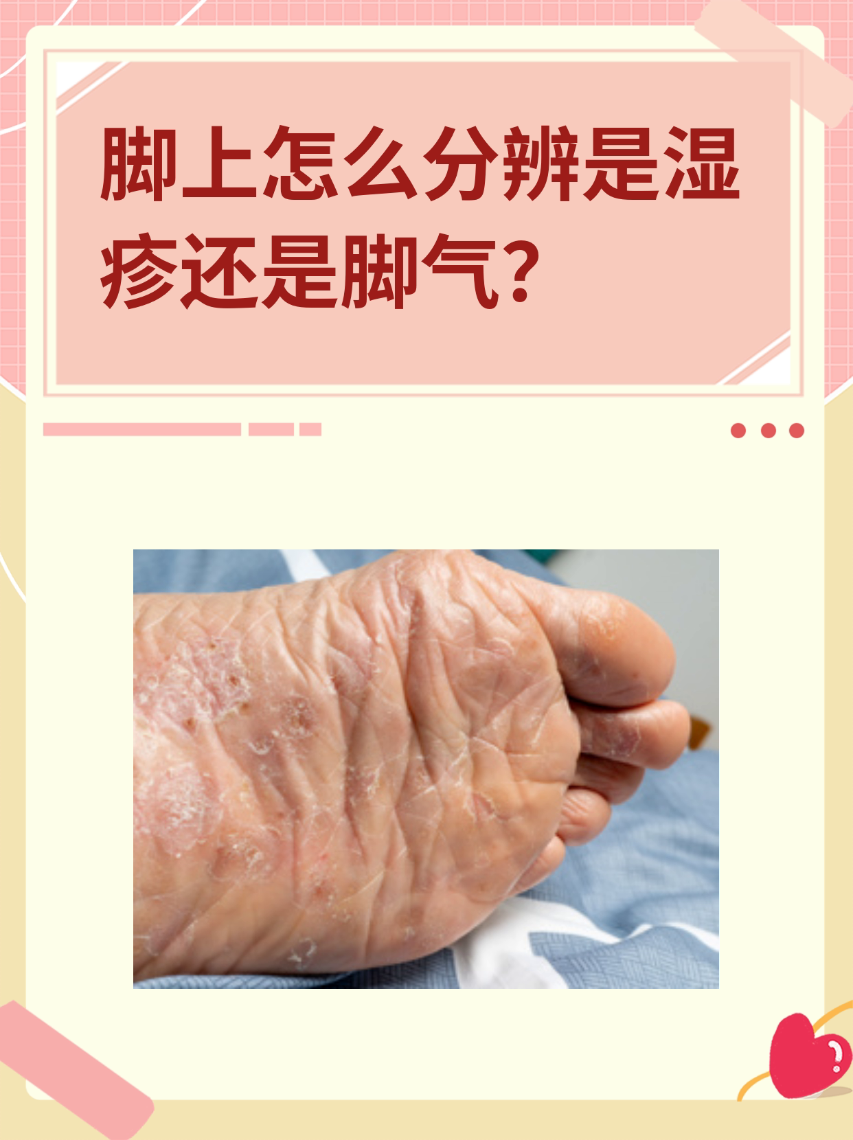脚上怎么分辨是湿疹还是脚气