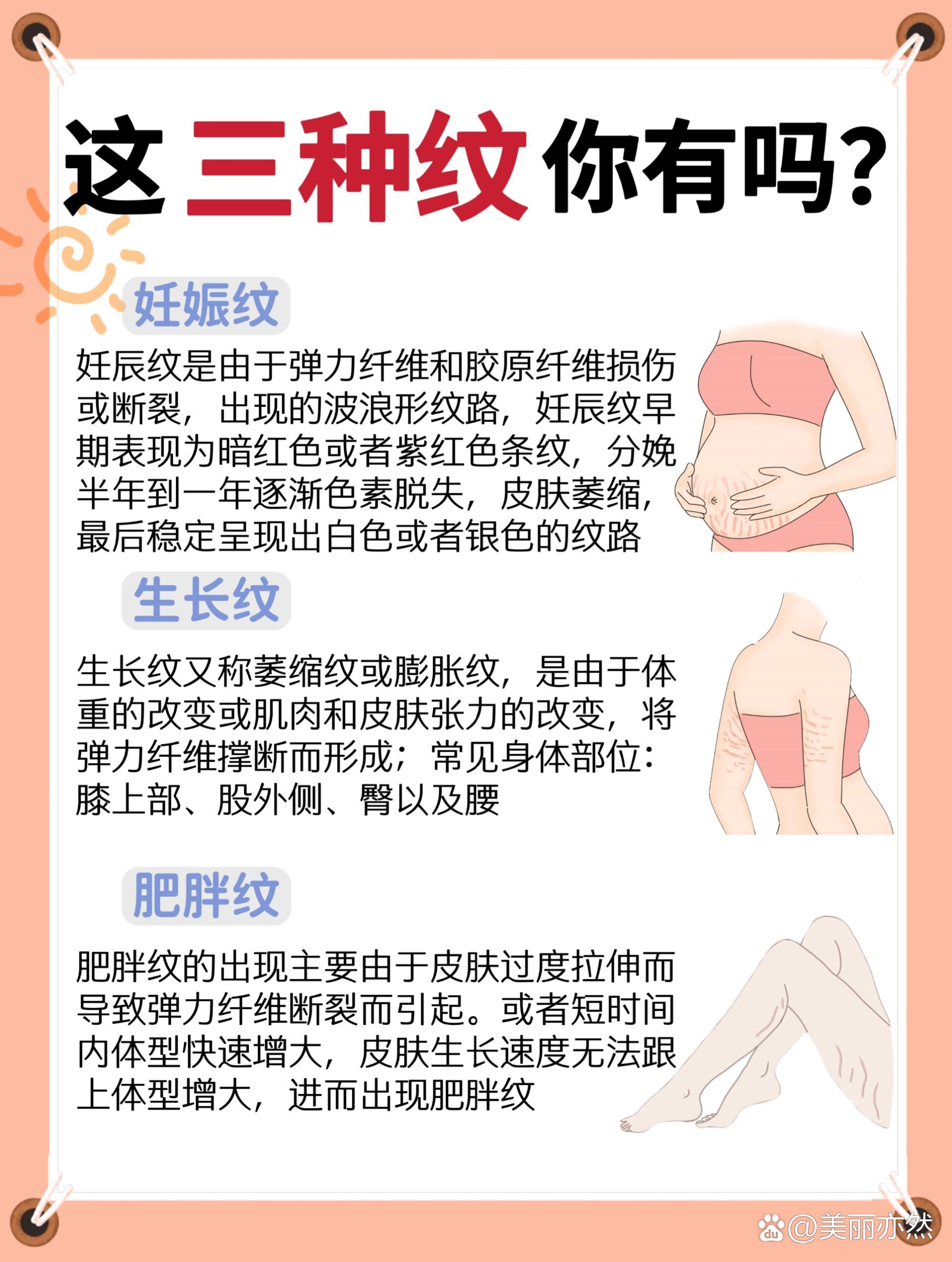 干货|妊娠纹,生长纹,肥胖纹修复攻略75