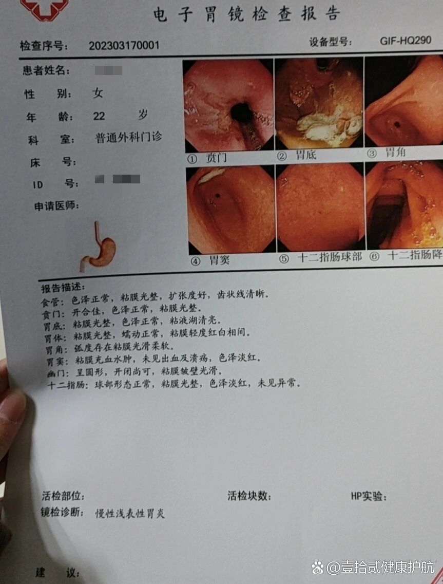 普通肠胃镜,肠炎?