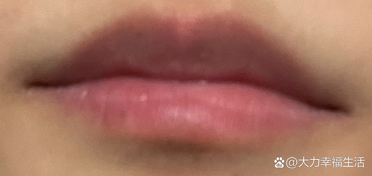 嘴唇边上长了小黑点