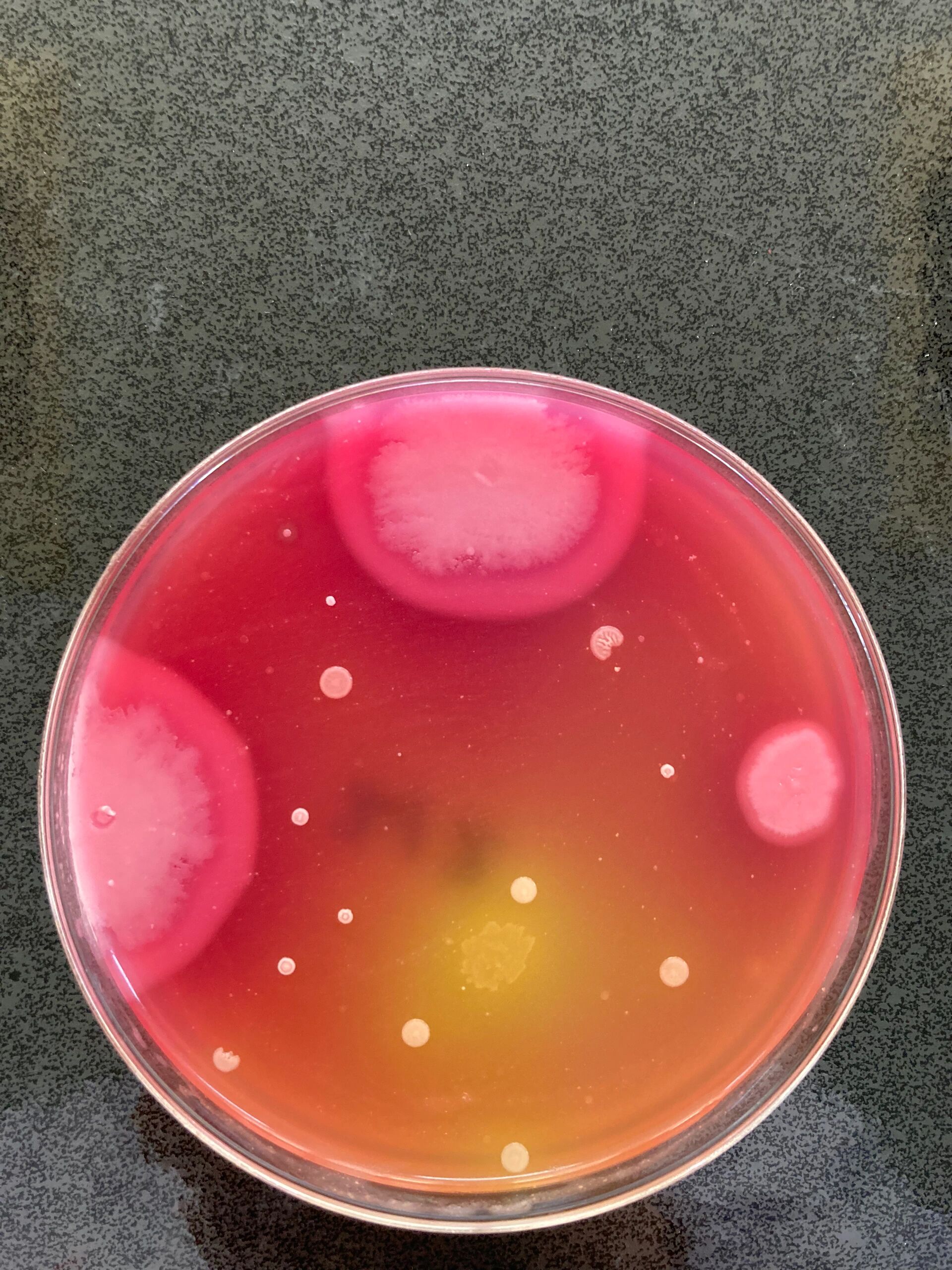 更加典型  br>蜡样芽孢杆菌myp平板蜡样芽胞杆菌分离在myp琼脂平板上