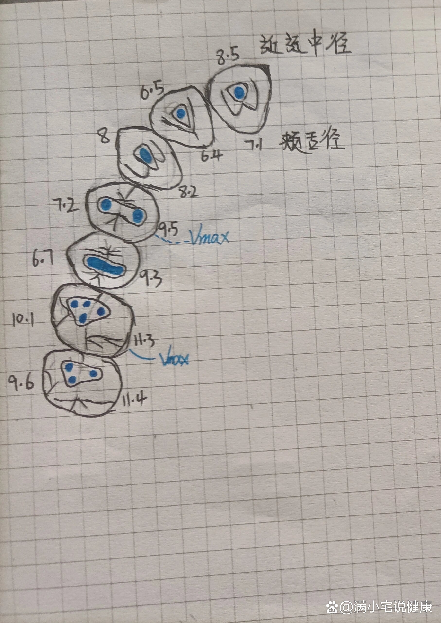 各个牙的开髓法图片图片