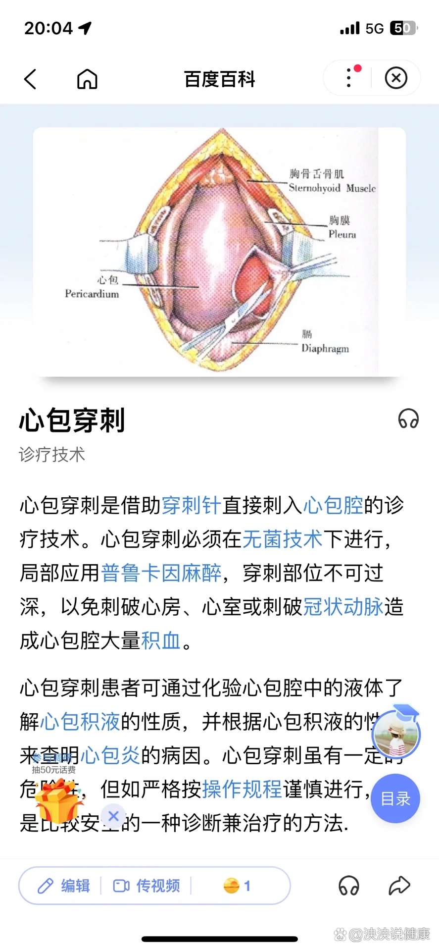 心包囊肿切除术图片