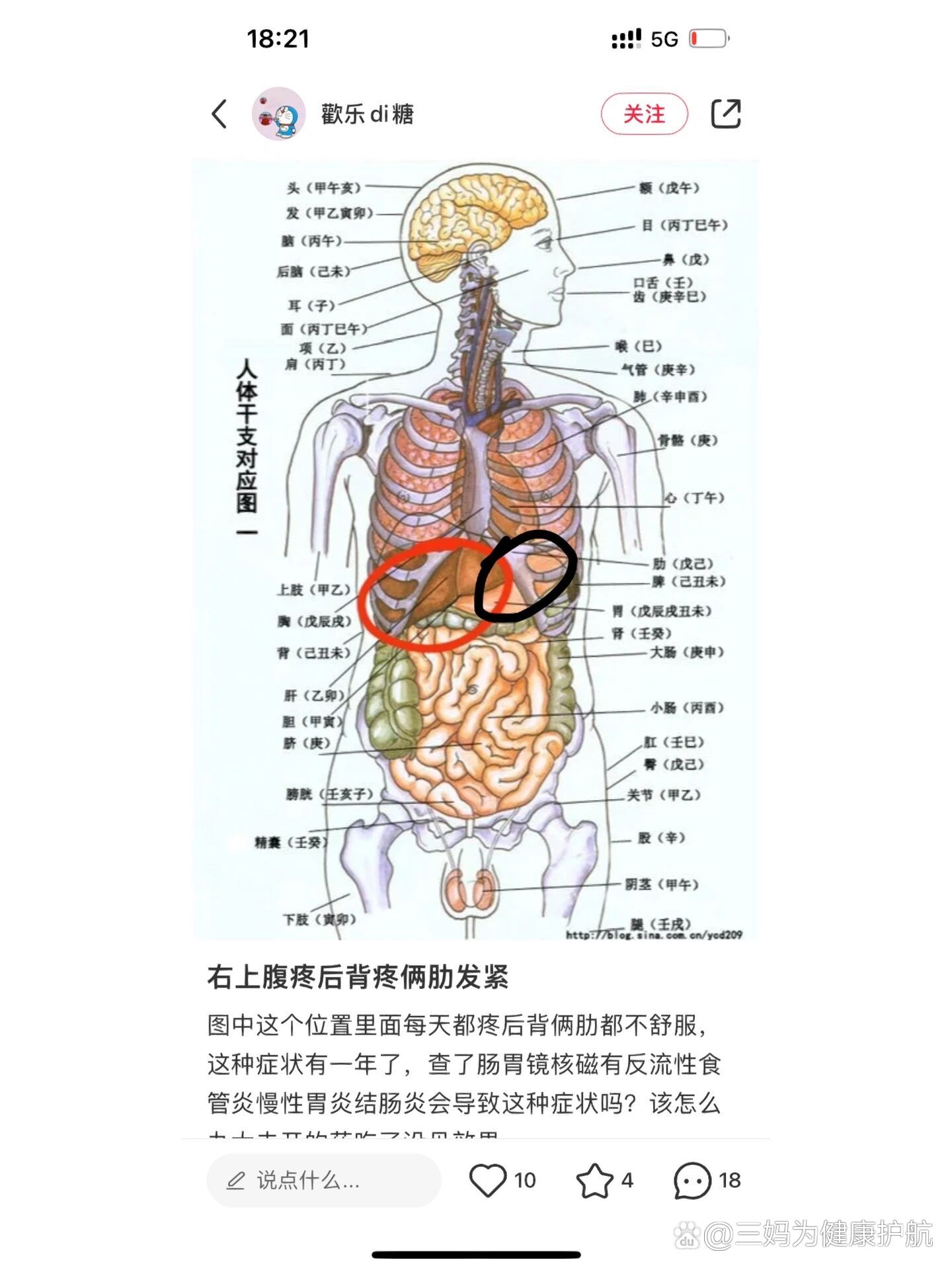 左边肋骨痛找到原因了