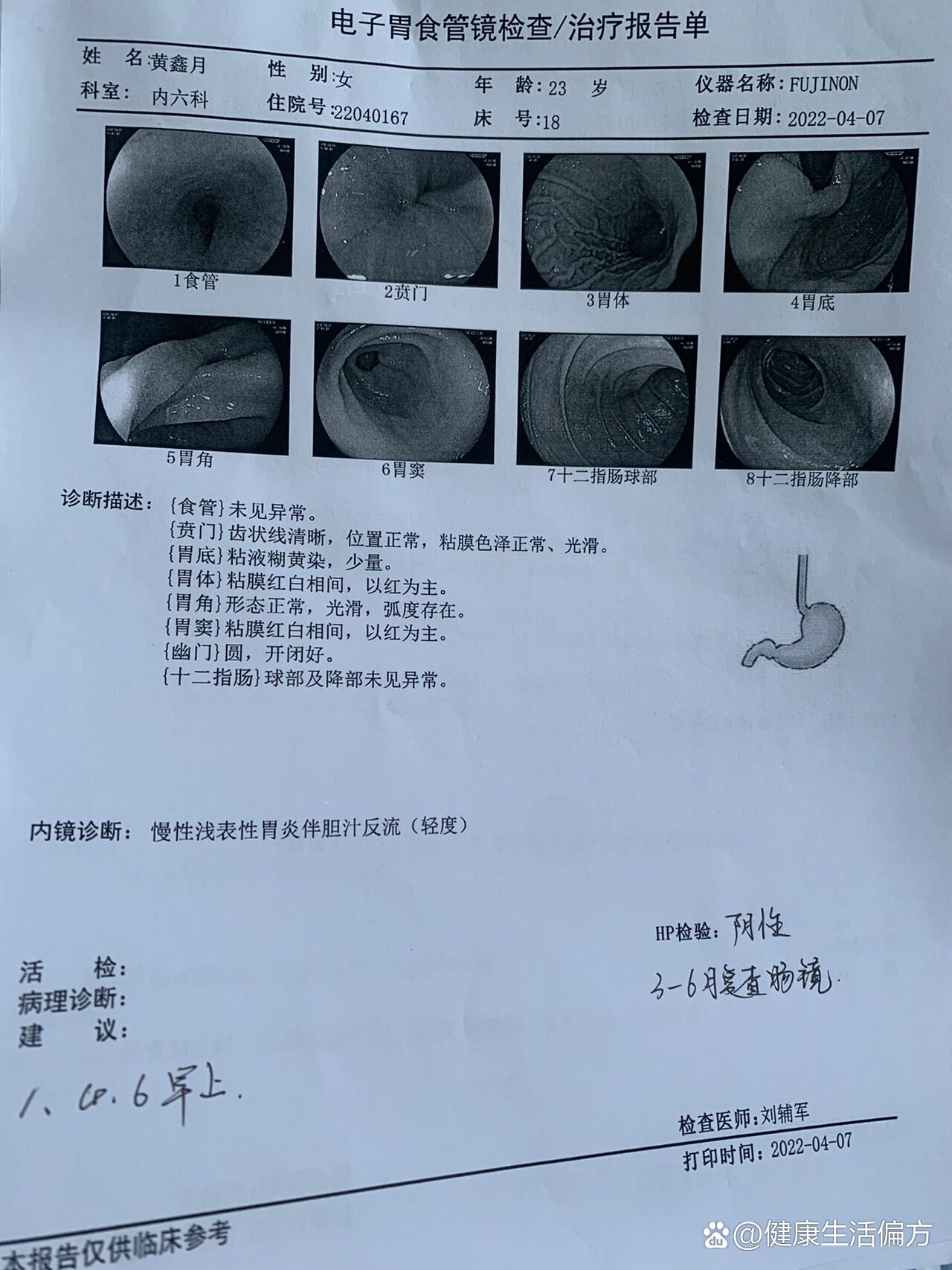 开心但是还是要调理吃药三个月之后还要重新做肠镜复查!