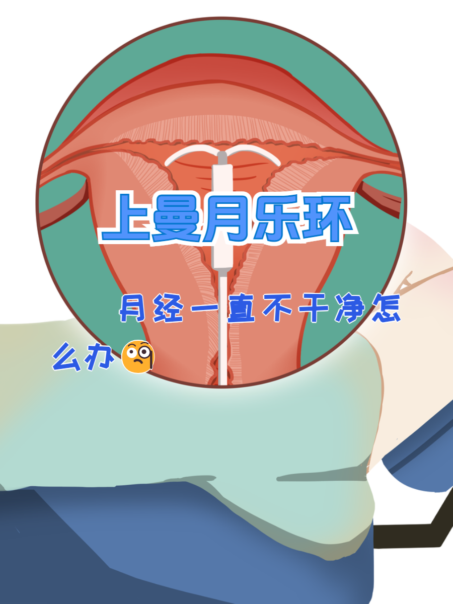 上曼月乐环月经不干净,处理方法你选择对了吗?