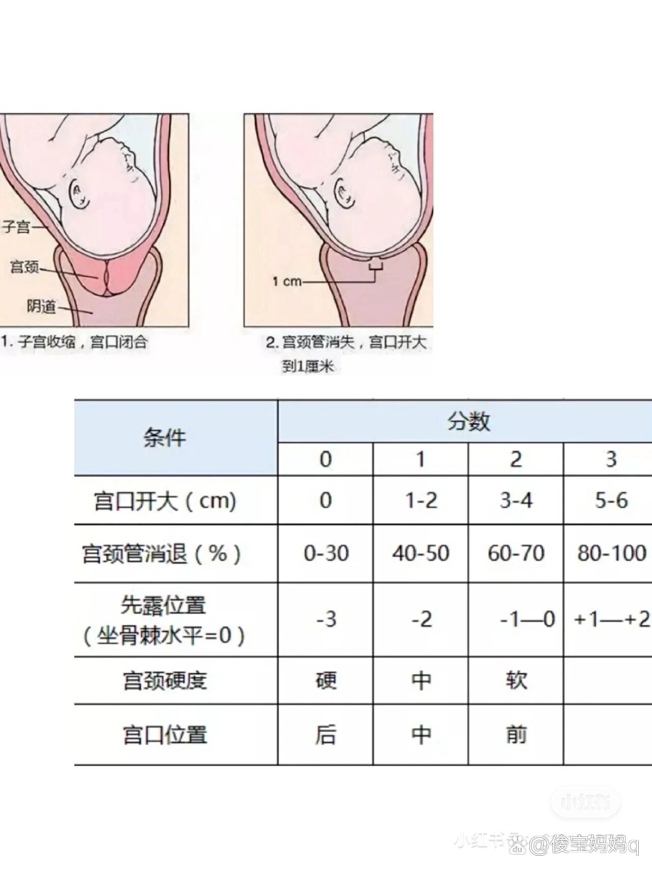 让医生看看有没有机会顺产  br>内检了一下 宫口未开 位置居中 宫颈管