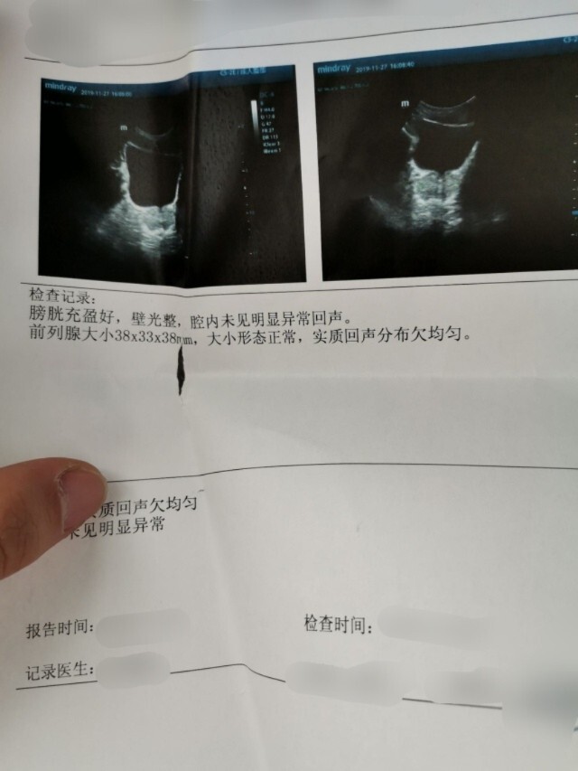 前列腺正常彩超图图片