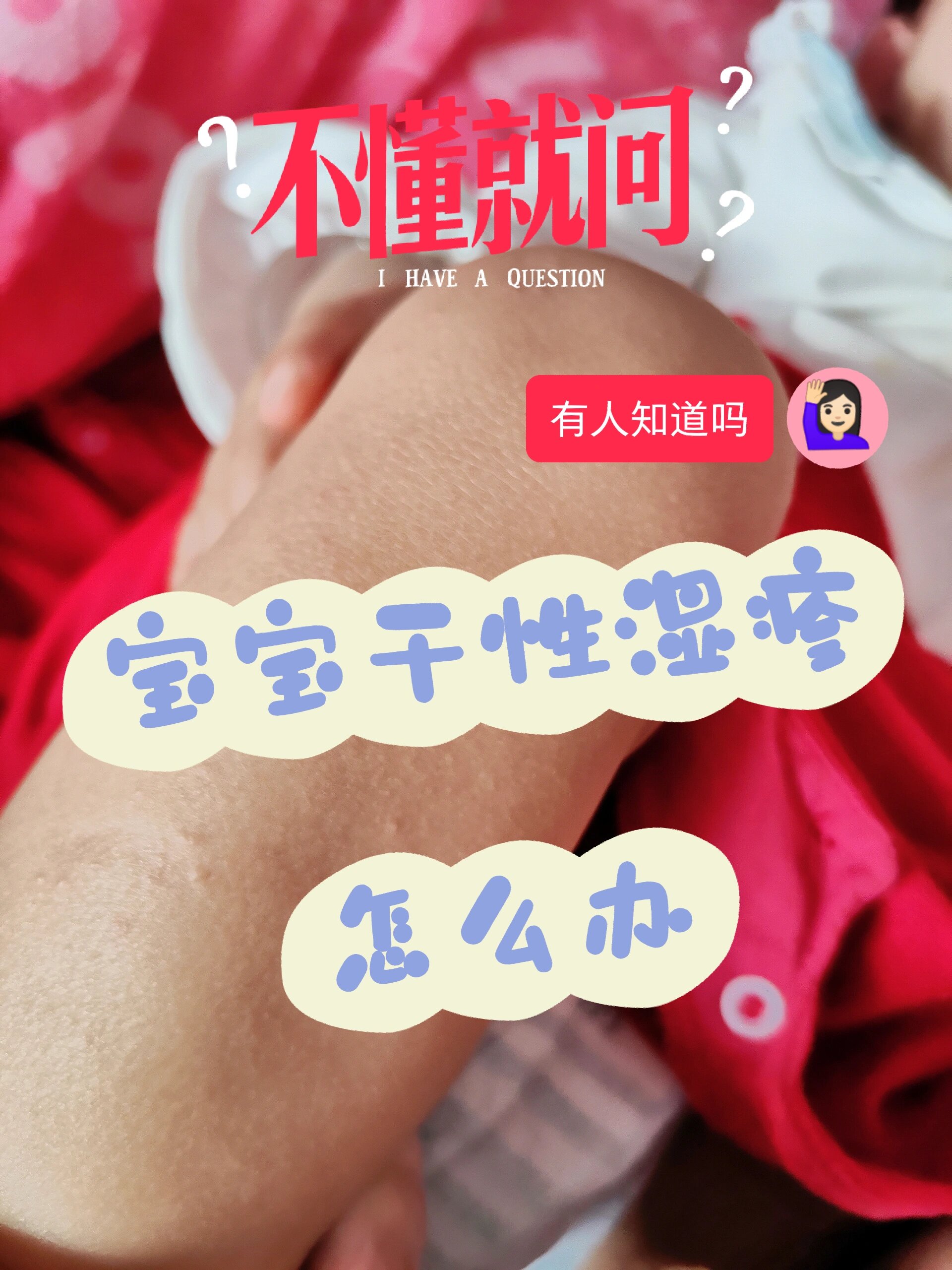 宝宝干性湿疹非药物日常护理
