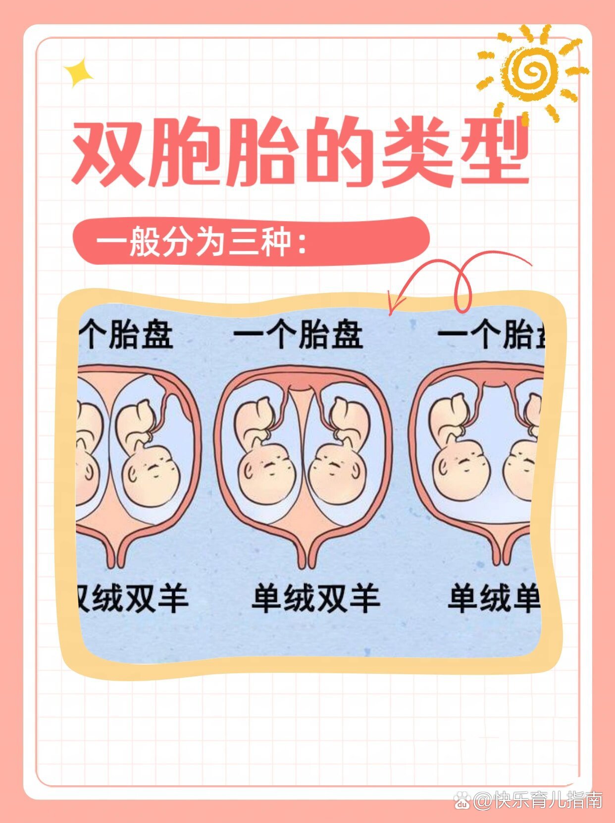 双胞胎的几种类型,你都知道吗