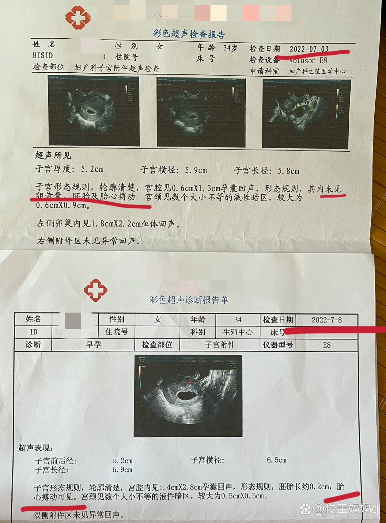 怀孕彩超42天图片