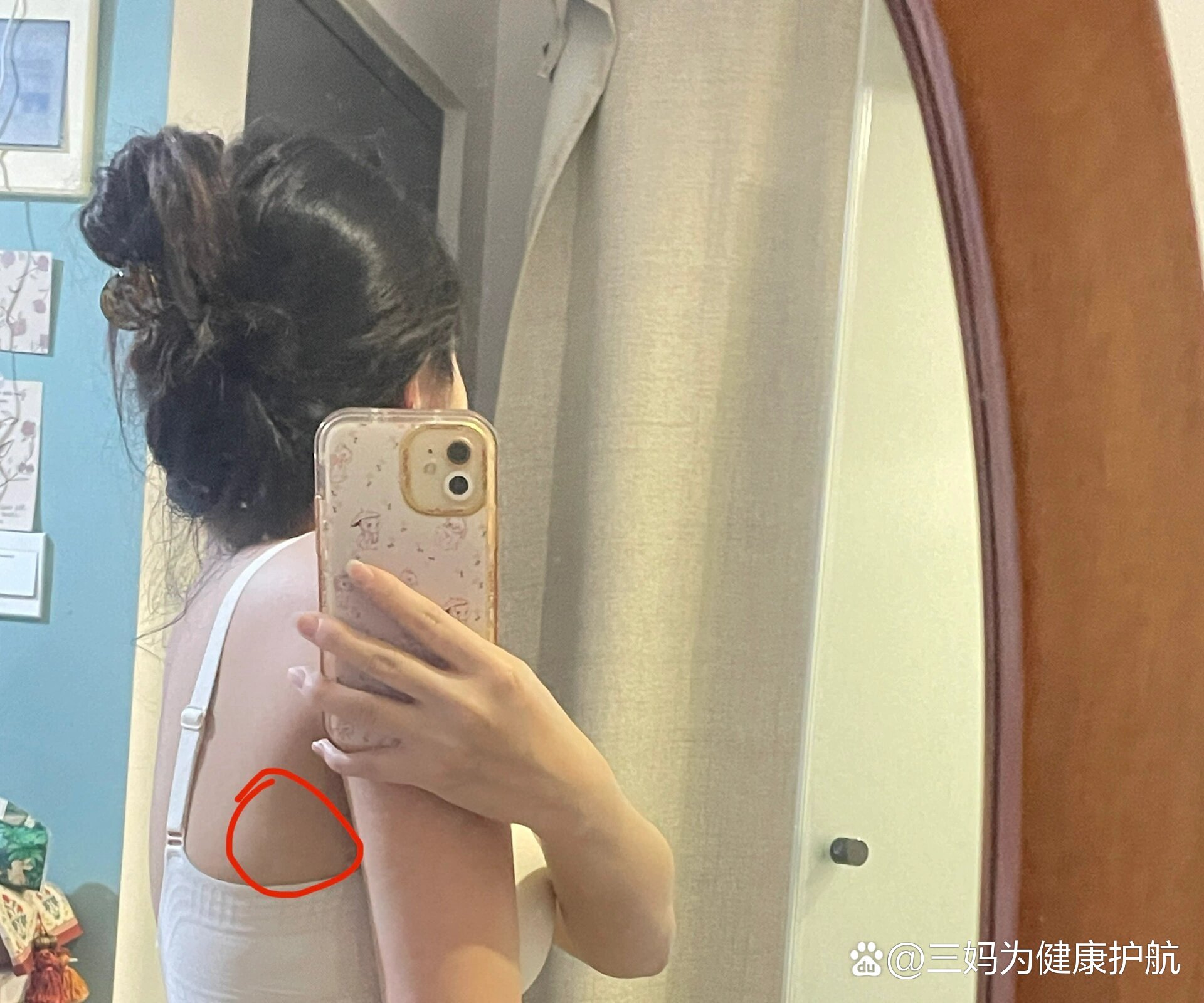 女左胸上方靠近腋窝疼图片