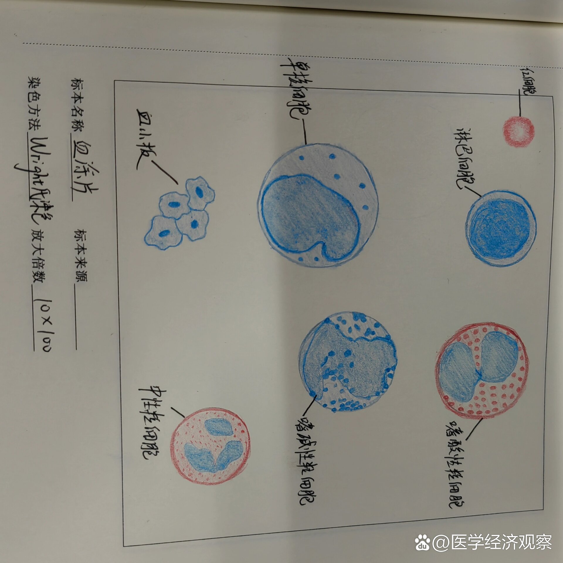 晚幼红细胞红蓝铅笔图图片