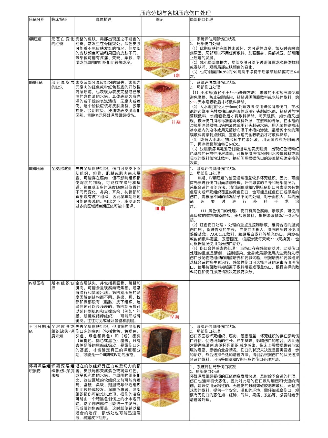 压疮分期图片