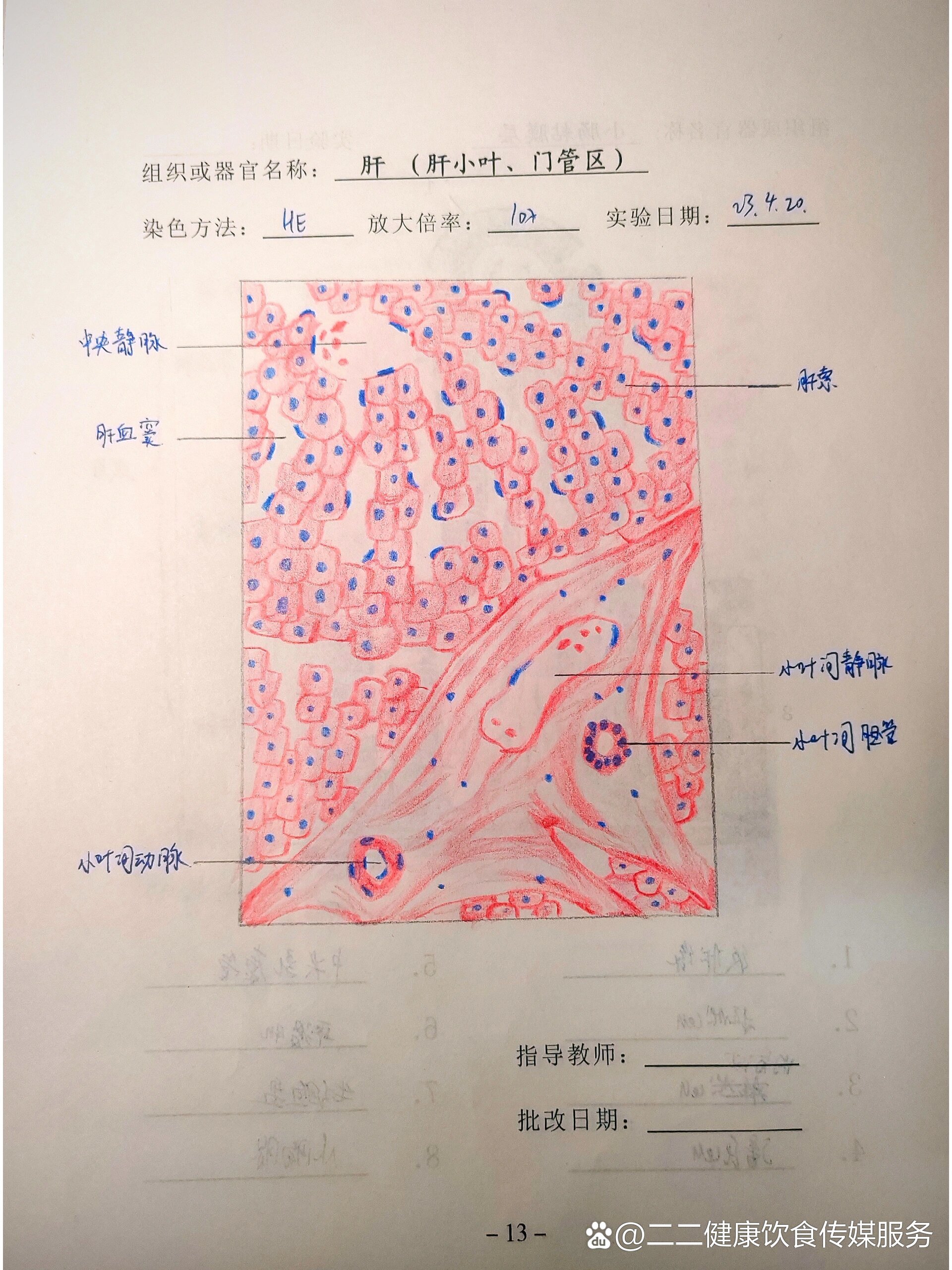 肝(肝小叶,门管区)红蓝铅笔绘图