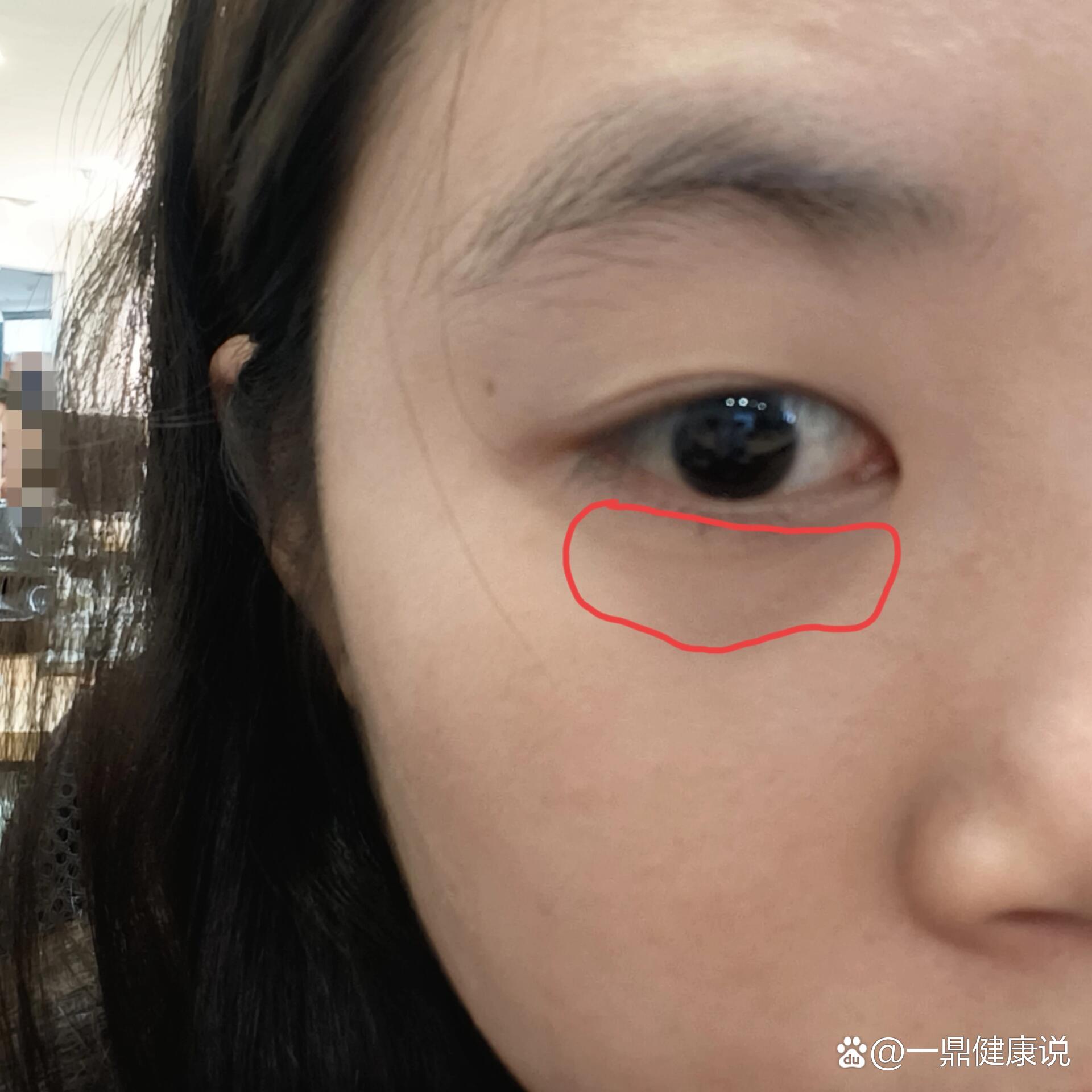  p>下眼皮抽筋 br>下眼皮时不时抽搐,已经快半个月了  br>	  br>不