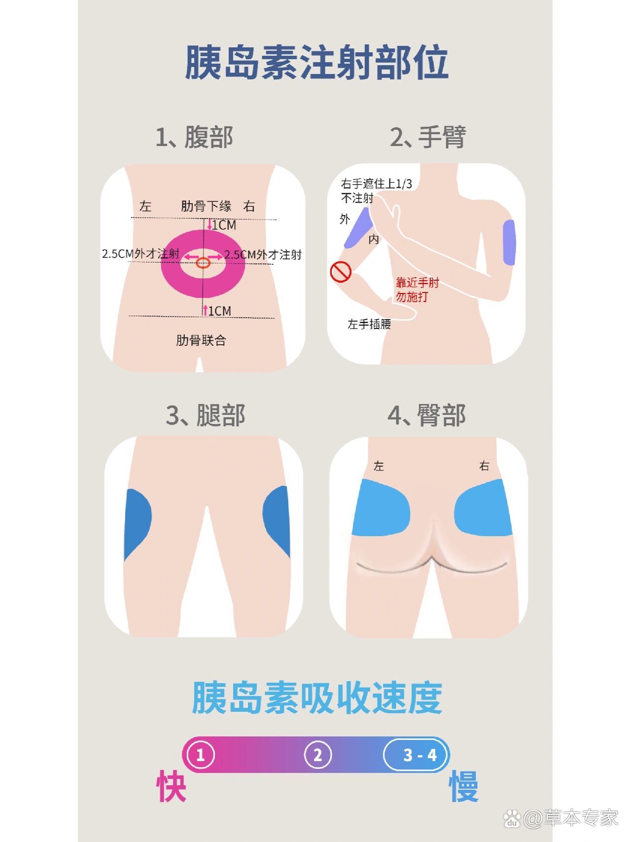 胰岛素打腿的位置图图片