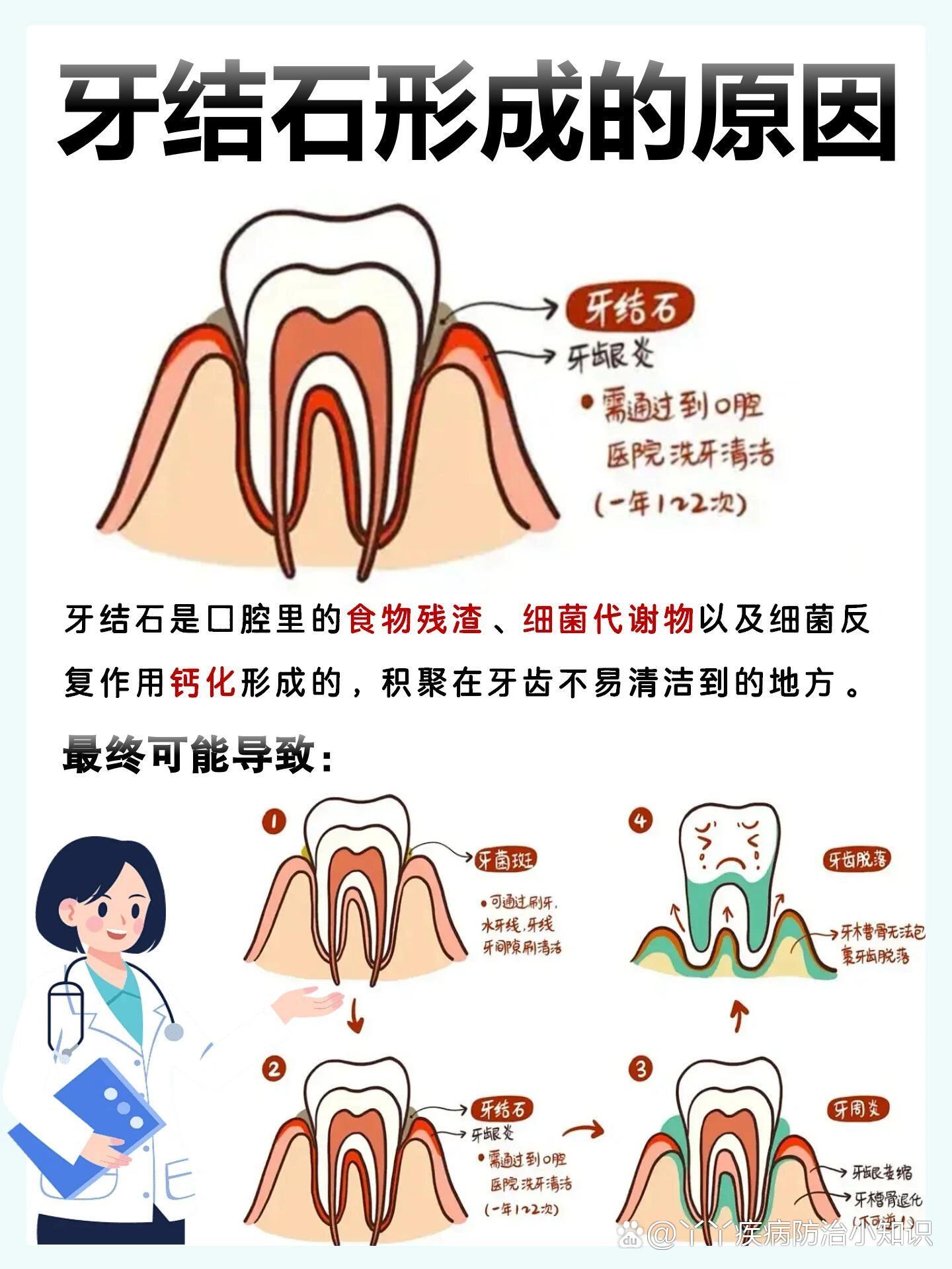 儿童牙齿钙化的原因图片