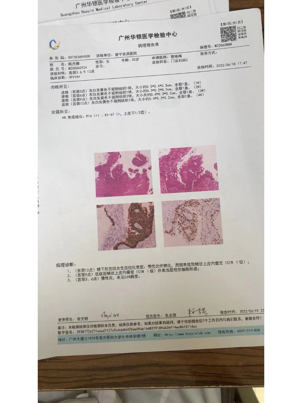 免疫组化报告图片图片