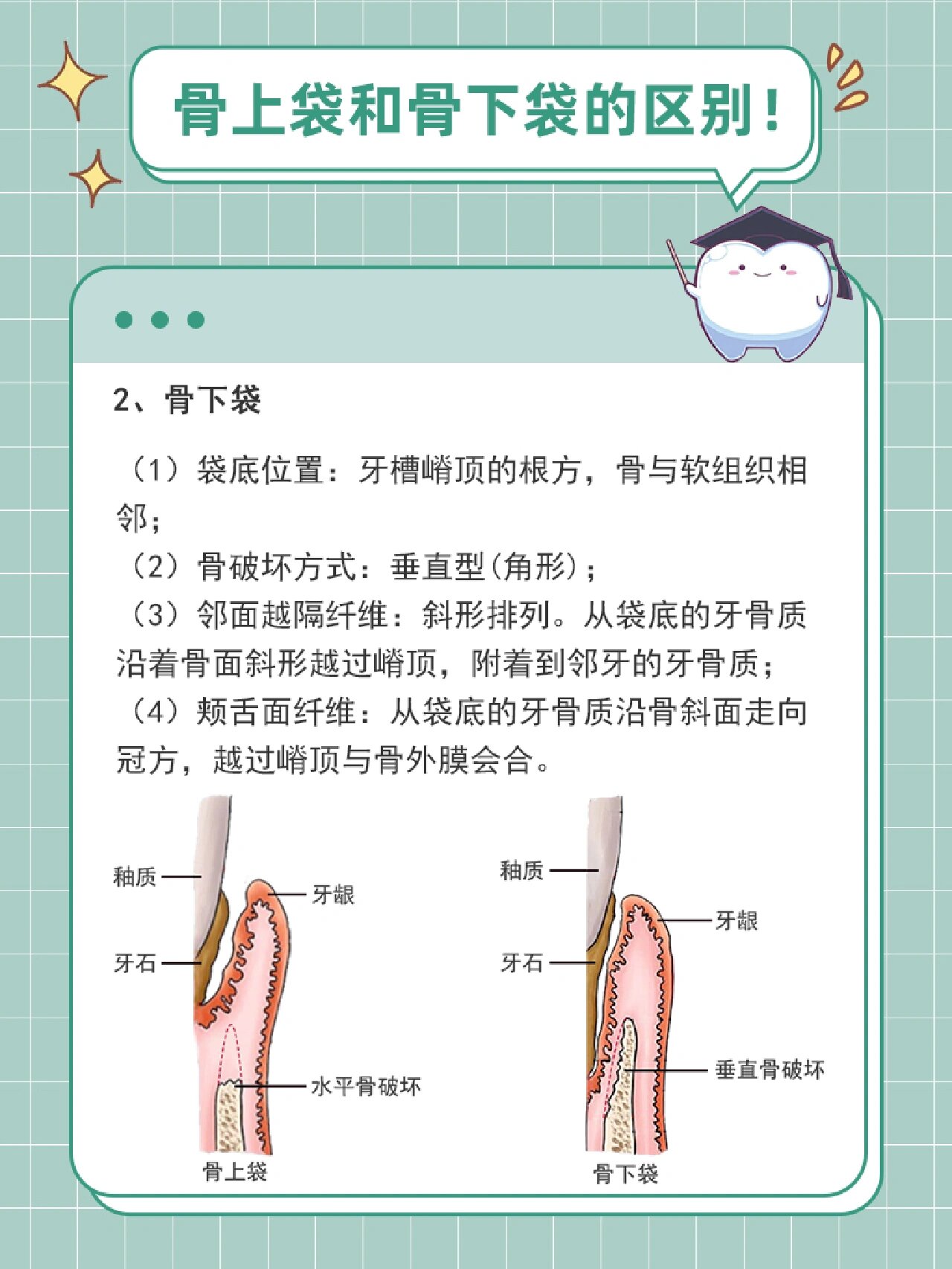 骨上袋和骨下袋有什么区别❓