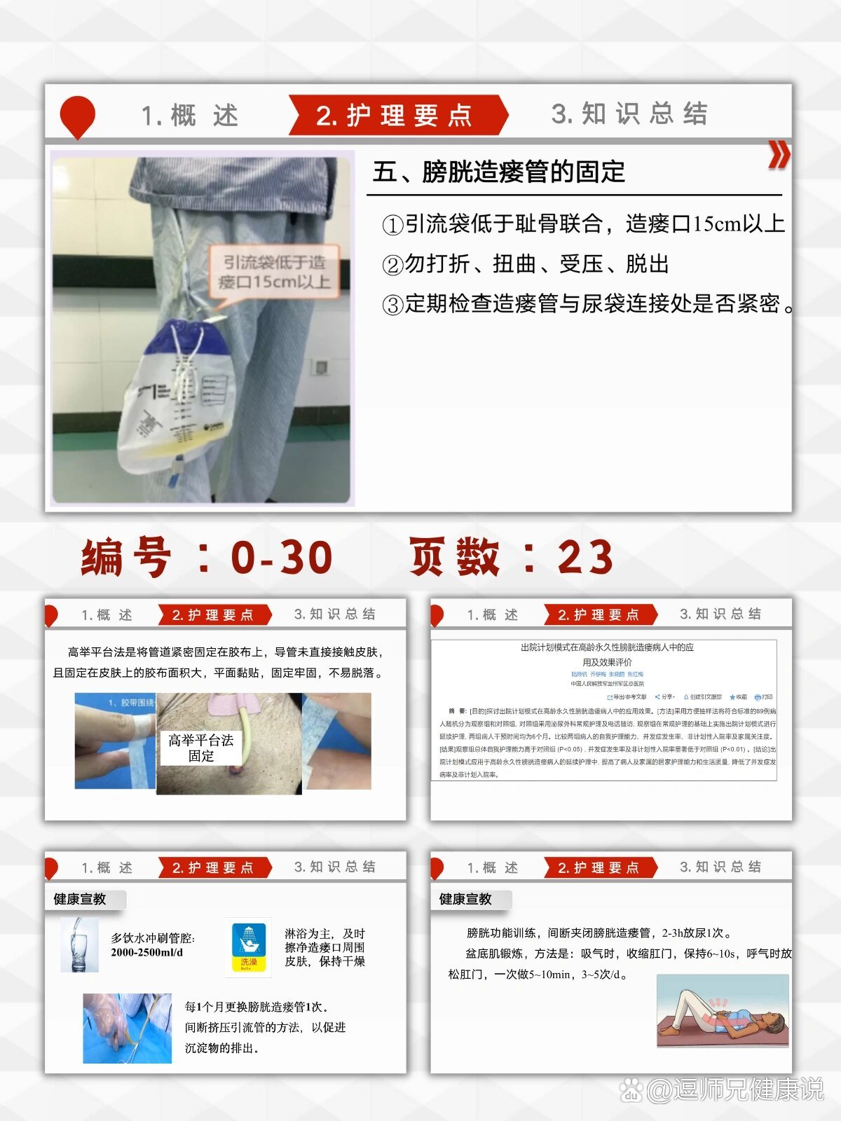 泌尿外科康复科膀胱造瘘管的护理ppt模板