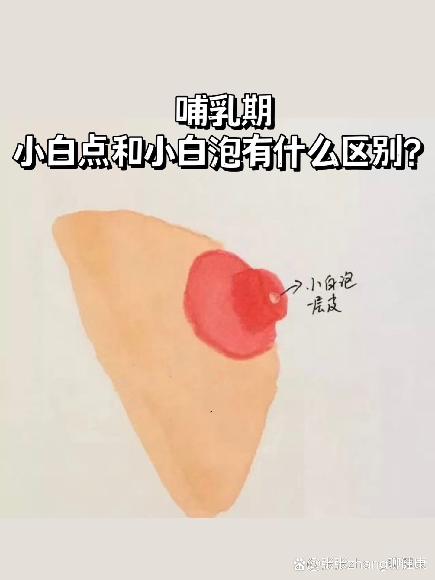 乳头里面有白色颗粒图片