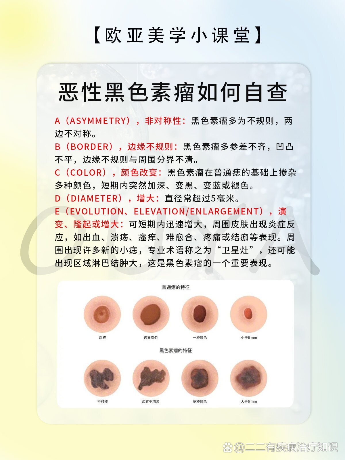 黑色素瘤和痣的区别