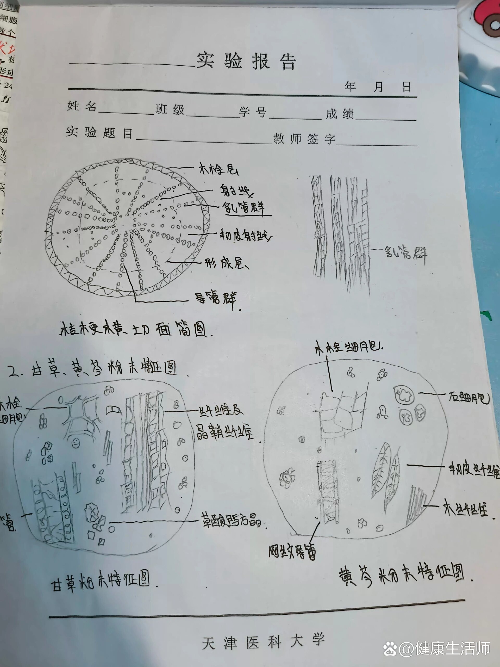 人参粉末图显微图片