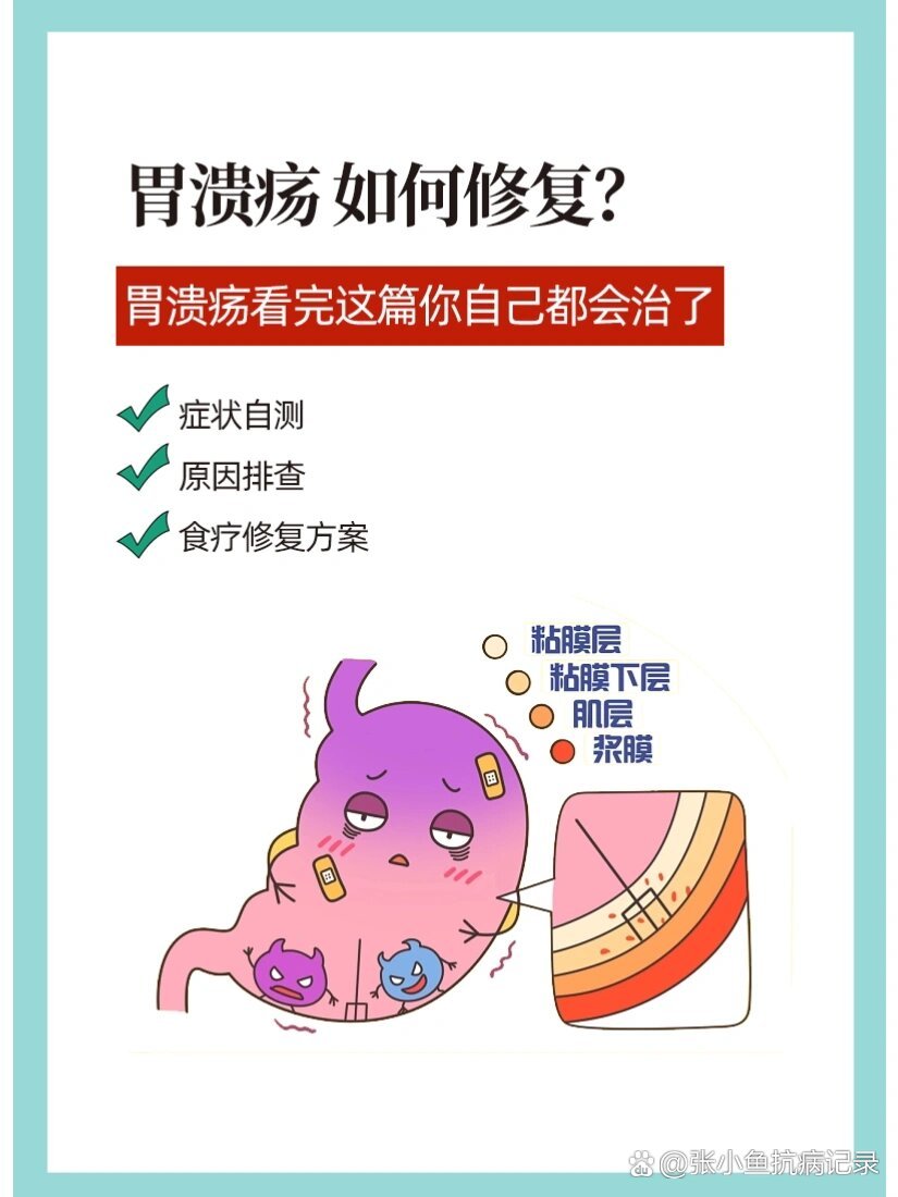 胃溃疡能治好吗图片