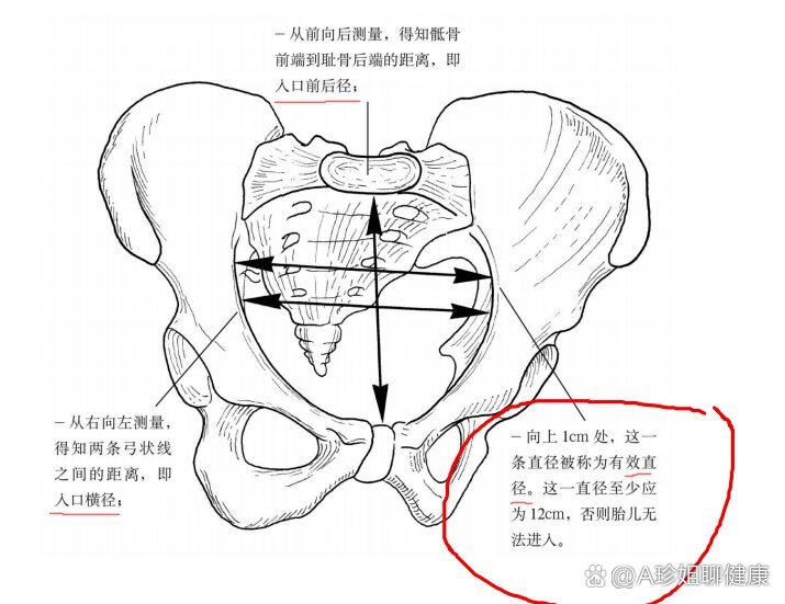 骨盆的三个分界线