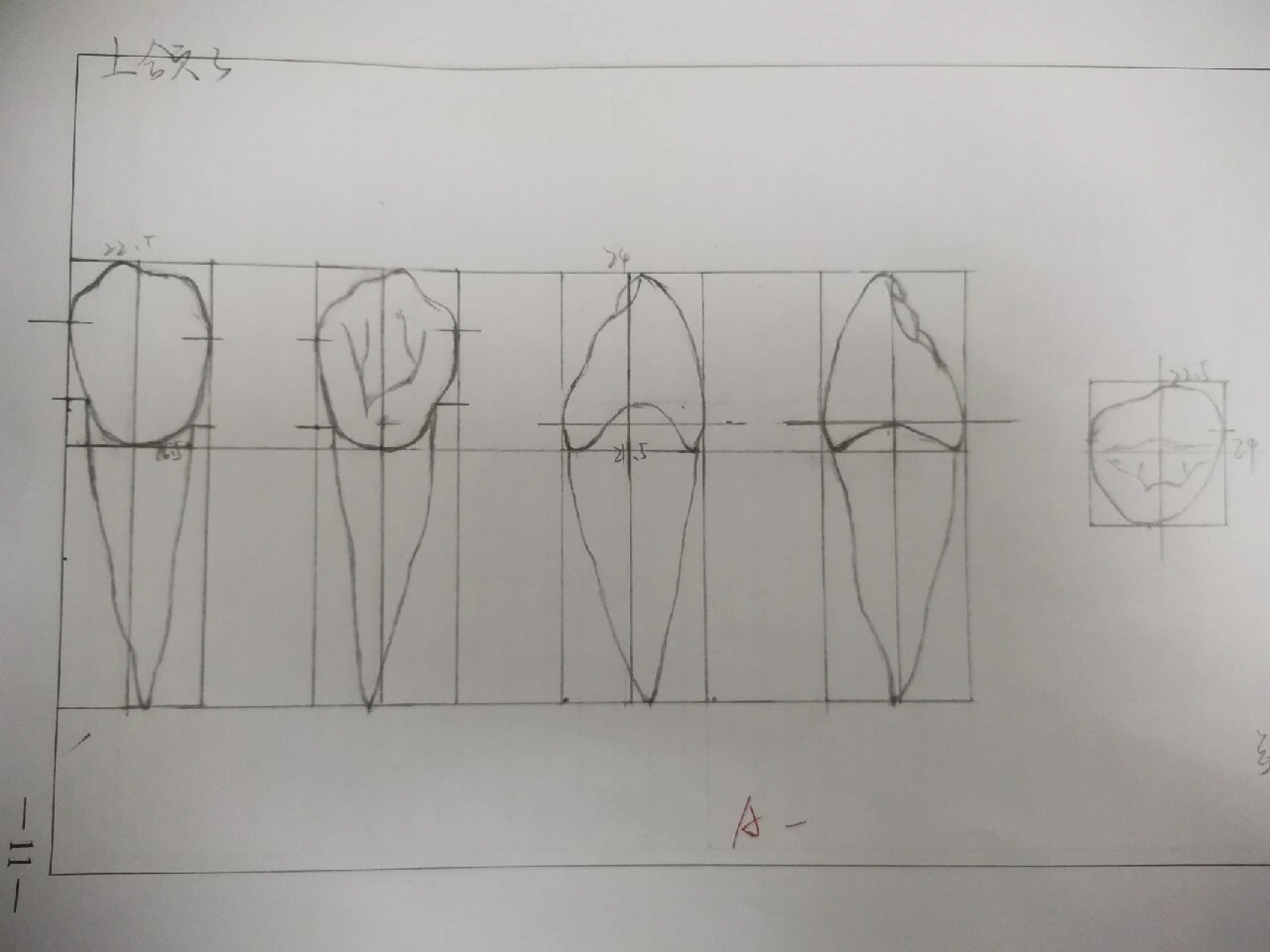 上颌尖牙(上颌3)