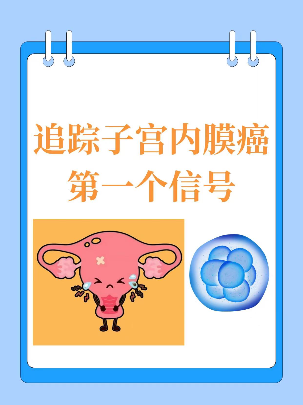 追踪子宫内膜癌的第一个信号