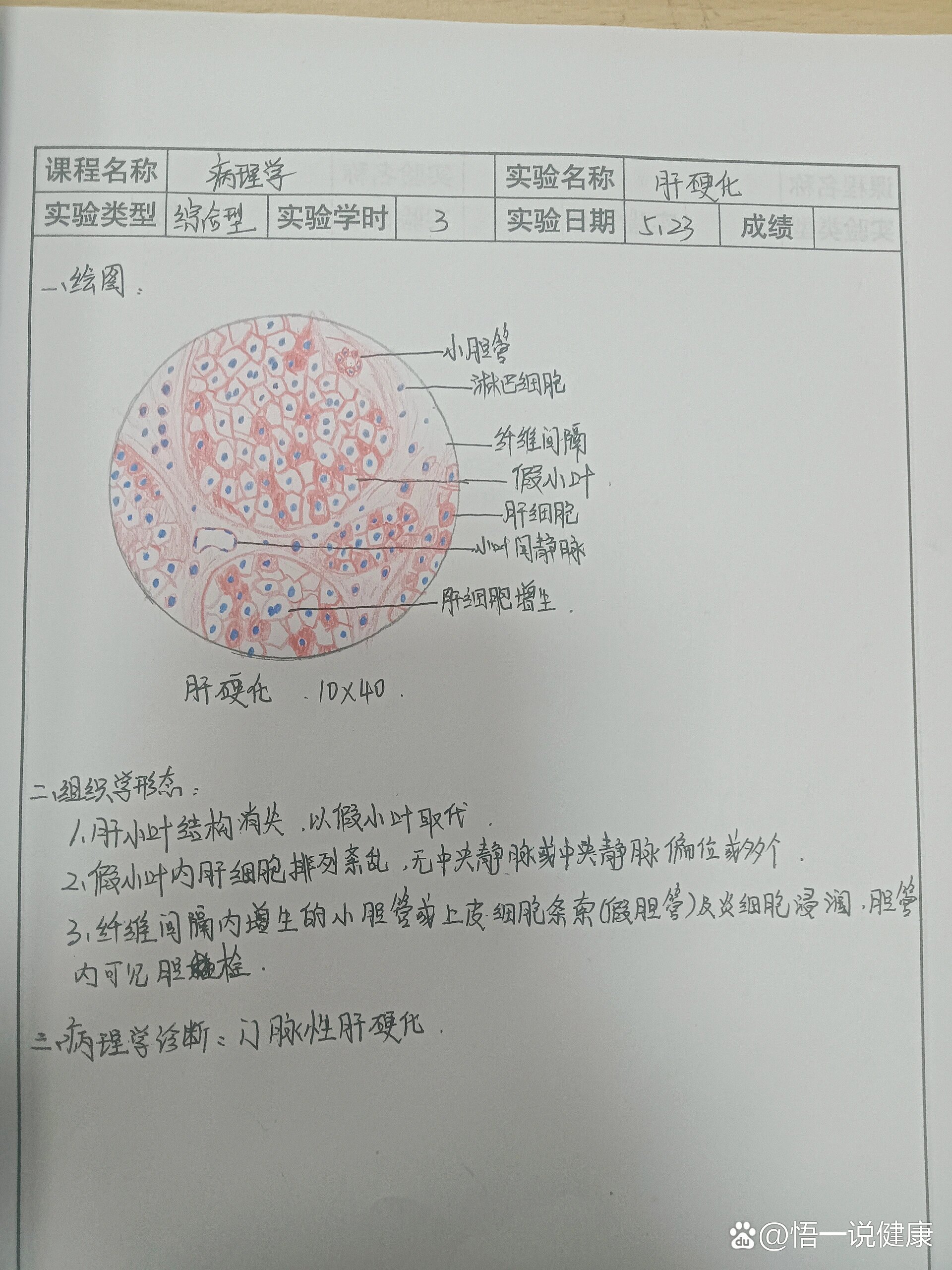 肝脏红蓝铅笔手绘图图片