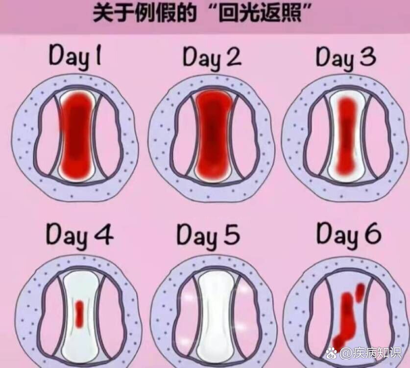 月经干净几天后,又继续流血是怎么回事?