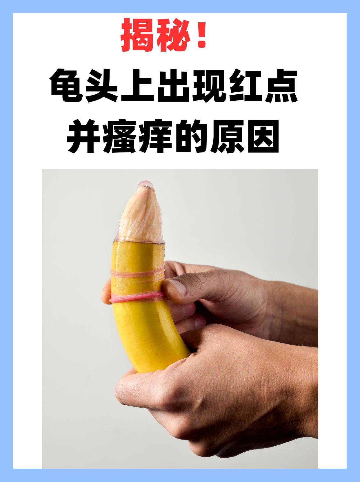 揭秘!龟头上出现红点并瘙痒的原因.