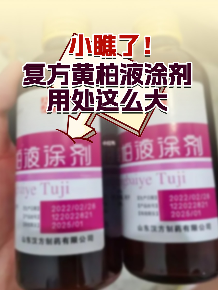 小瞧了!复方黄柏液涂剂用处这么大