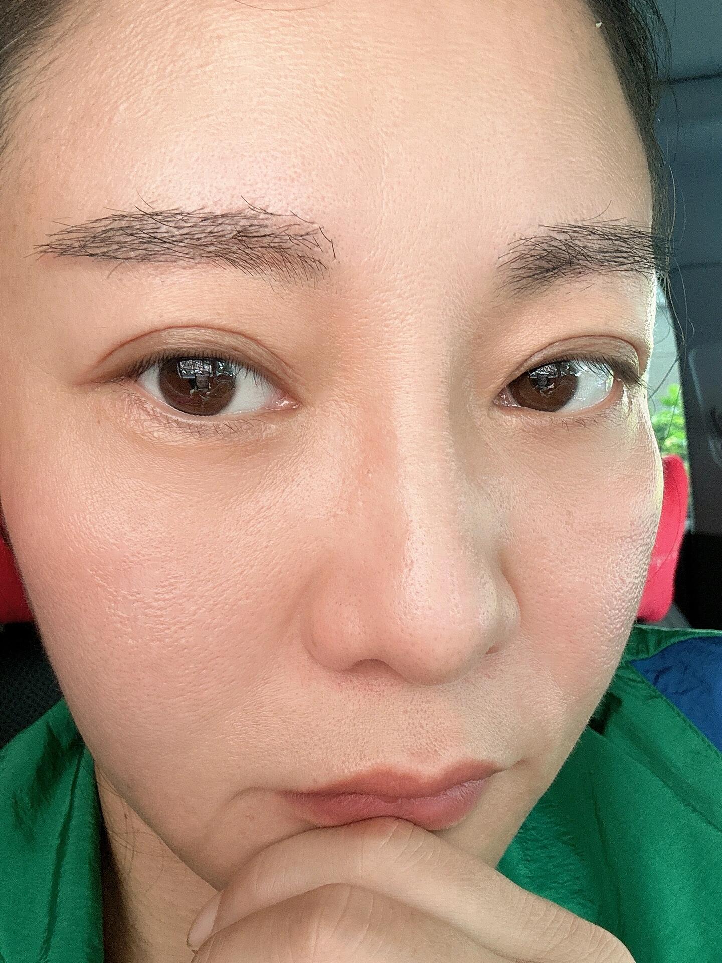 植眉一年多的真实反馈